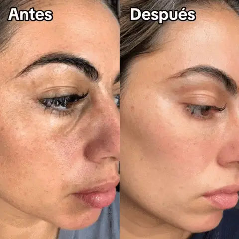 Resveratrol | Detén el envejecimiento desde dentro y recupera una piel más joven y firme