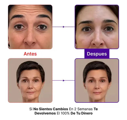 Resveratrol | Detén el envejecimiento desde dentro y recupera una piel más joven y firme